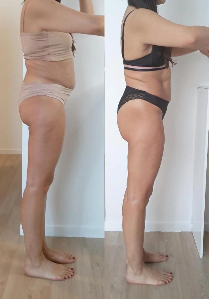 Résultat avant après soin Dianita Massages
